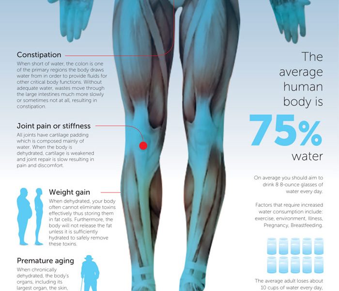 Why Dehydration Is Making You Sick Best Infographics 